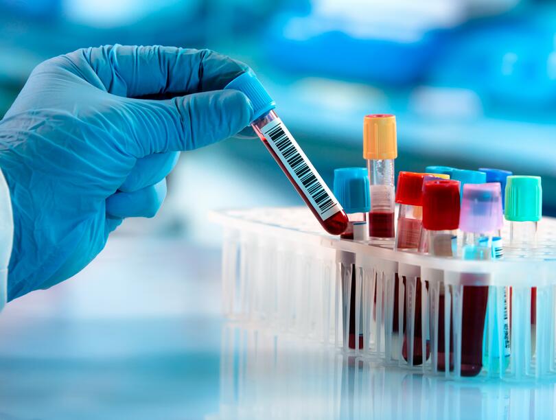 Gloved hand holds blood vial above holder containing other vials